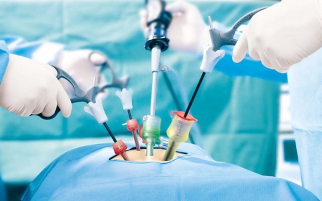 General & Laparoscopic Surgery